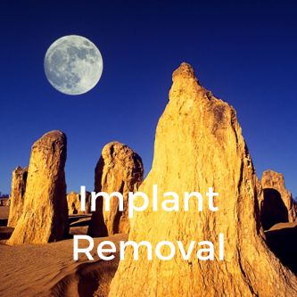 Implant Removal